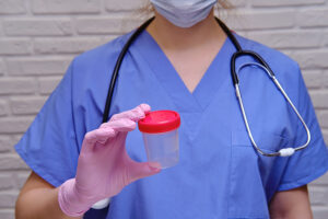 Medical professional wearing protective gloves and holding empty test jar; plastic container for urine sample