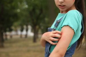 Young girl  in a park scratching an itchy insect sting on her arm