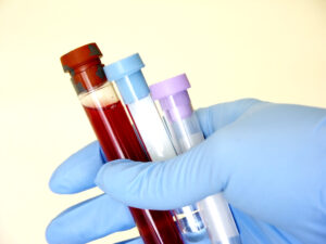 Medical provider holding lab test tubes in gloved hand